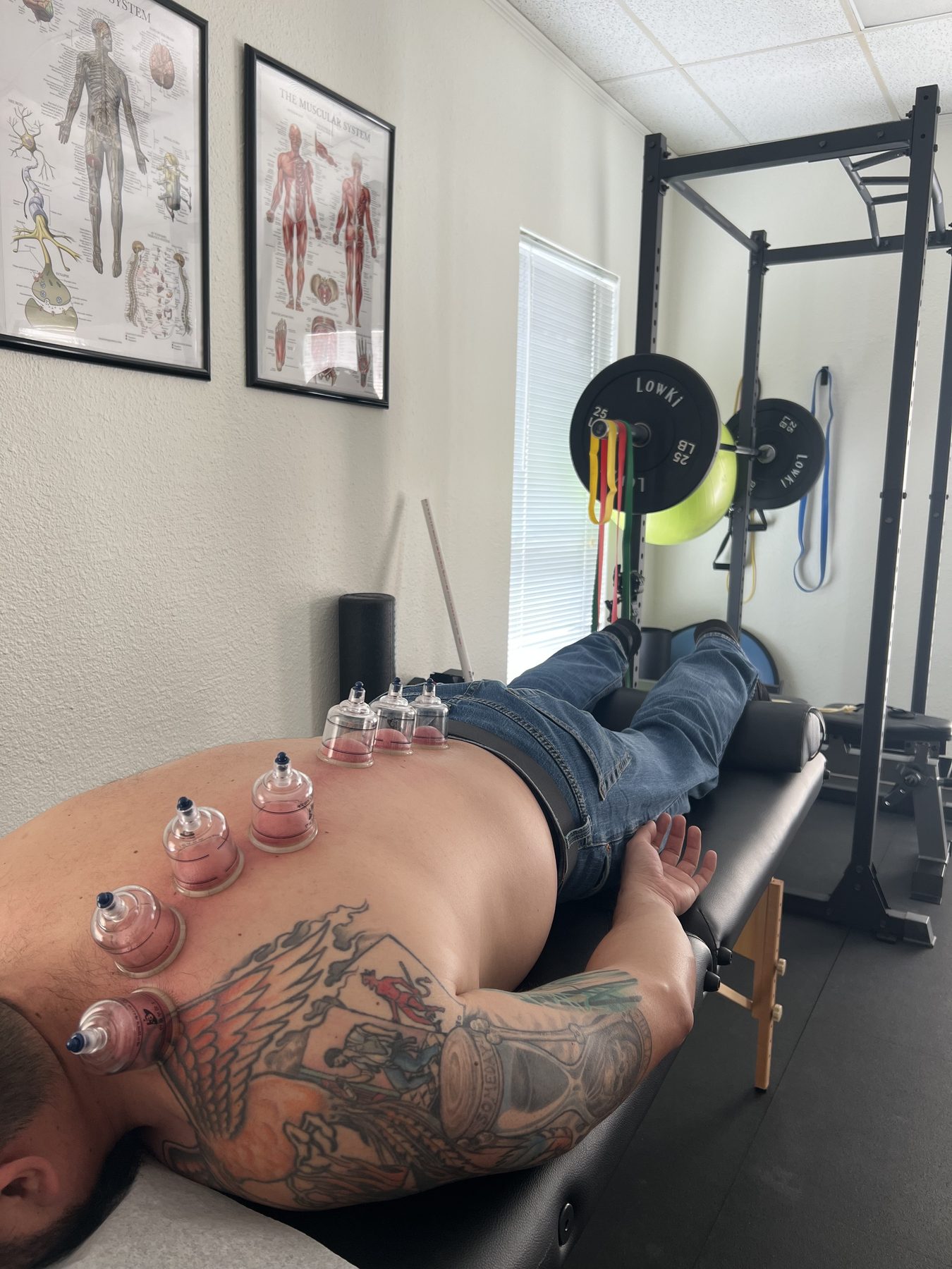 A patient with cups on his back on the treatment table, with the rehab rack and anatomy charts behind