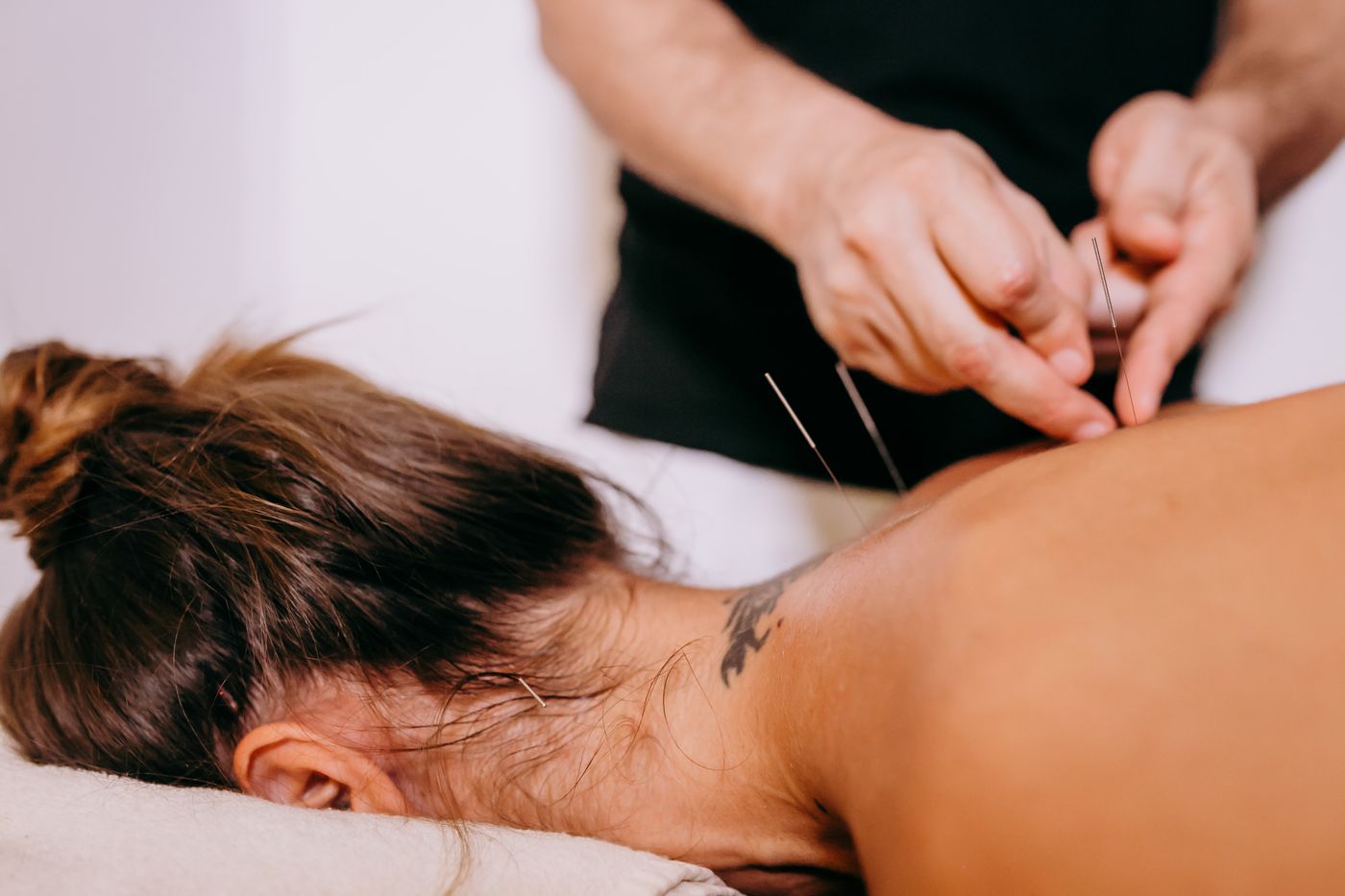 A practitioner needling a patient's neck and shoulder